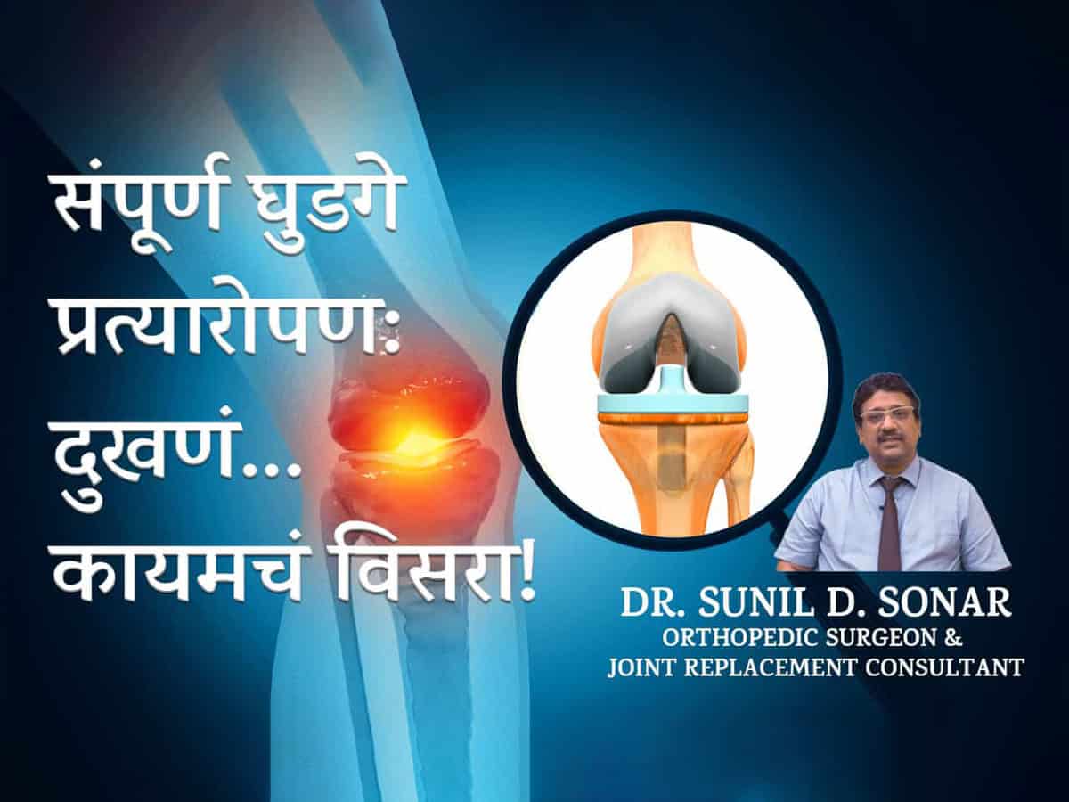Total Knee Replacement Surgery